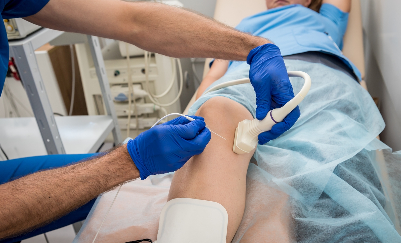 Orthopedic Surgeon Use Tubes And Ultrasound For Radiofrequency Catheter Ablation