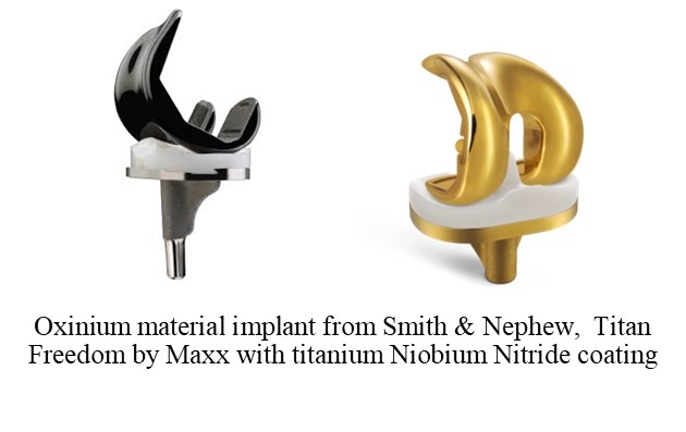 Oxinium And Titanium Niobium Nitride Coated Implants